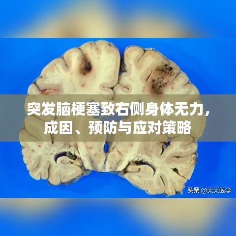 突发脑梗塞致右侧身体无力，成因、预防与应对策略