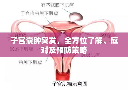 子宫囊肿突发，全方位了解、应对及预防策略