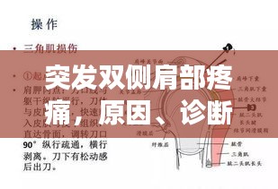 突发双侧肩部疼痛，原因、诊断及有效治疗方法全解析